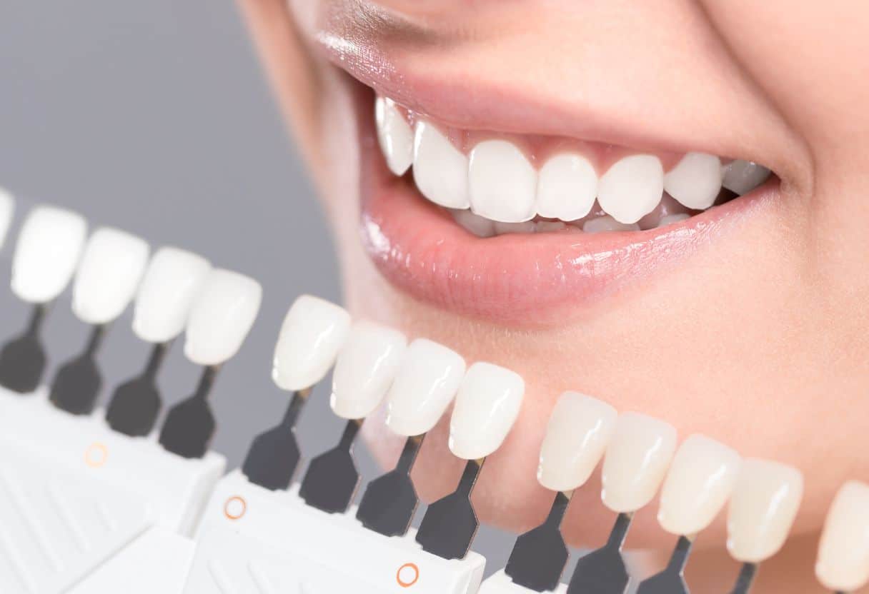 Die 10 effektivsten Methoden, um Zähne natürlich aufzuhellen